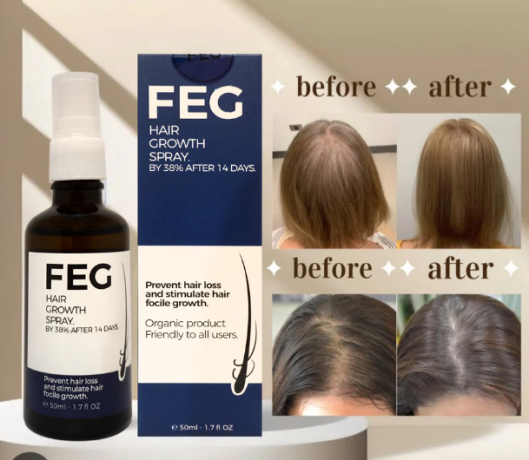 feg-hair-growth-spray-stop-hair-fall-regrow-naturally-03001819306-big-0